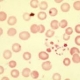 blood platelet